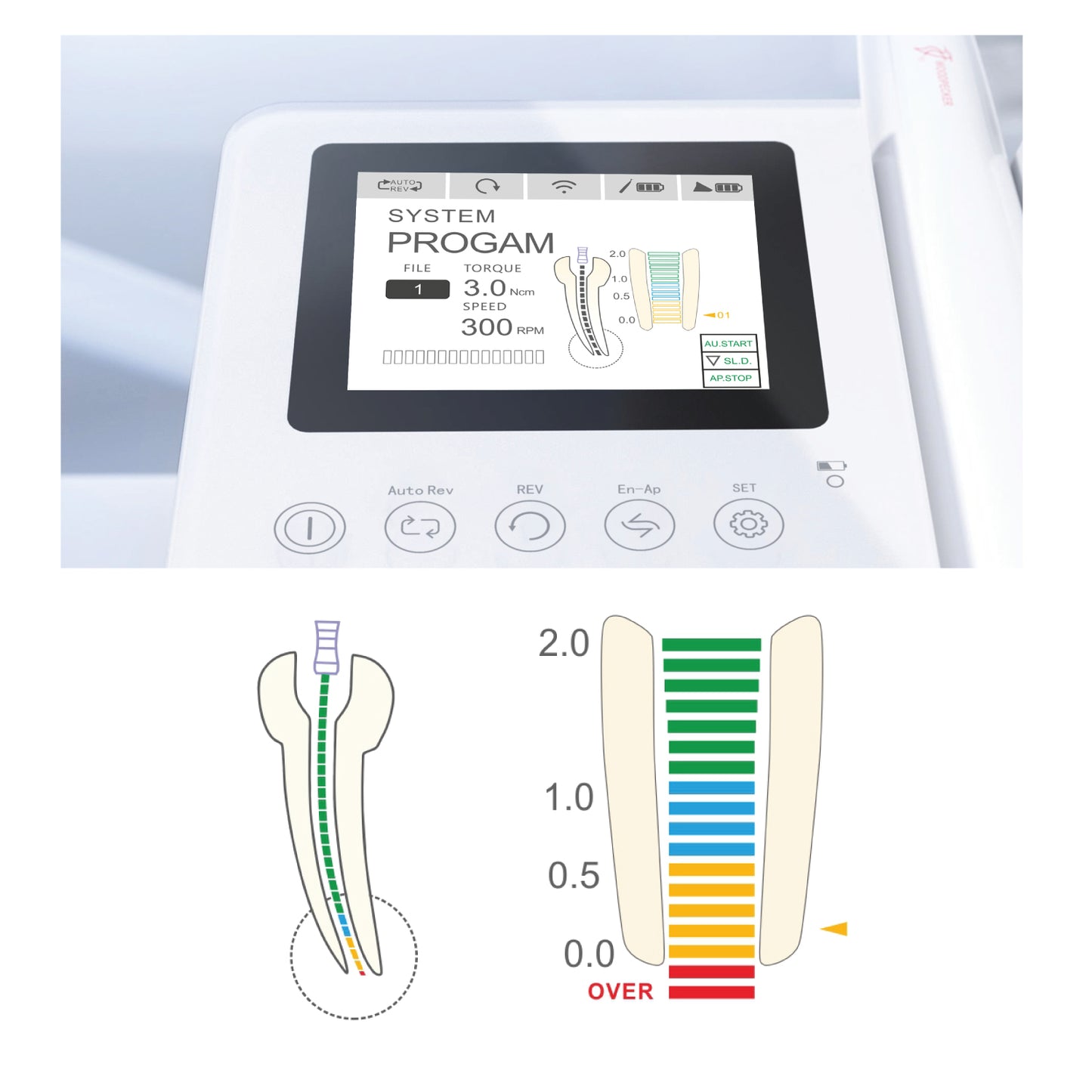 Woodpecker Endo Radar Pro Endo Motor & Apex Locator