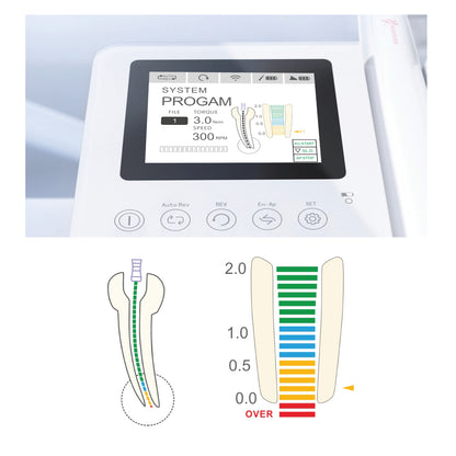 Woodpecker Endo Radar Pro Endo Motor & Apex Locator