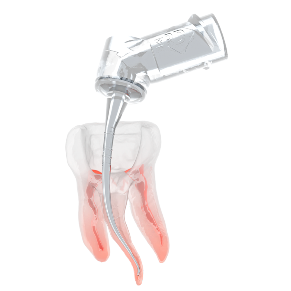 PD Dental IrriFlex Flexible Endo Irrigation Needles Root Canal