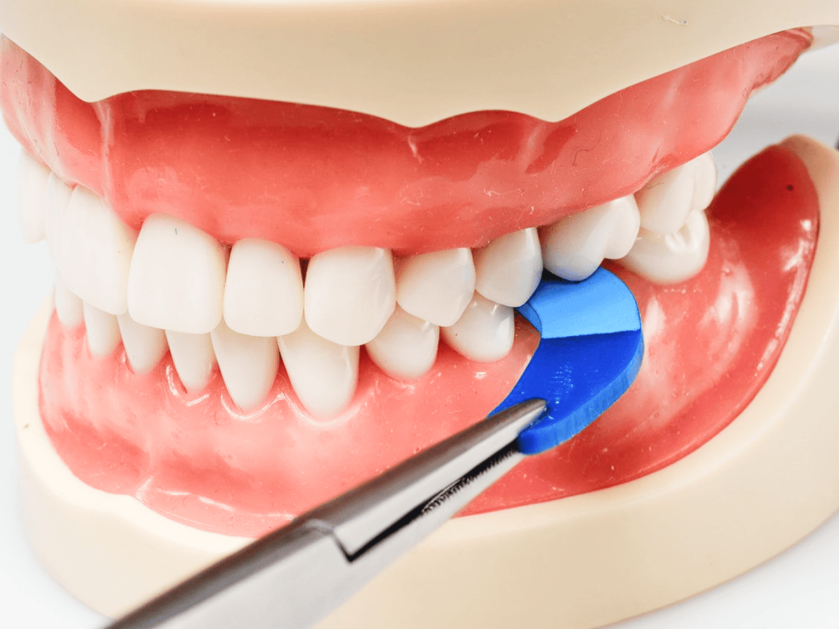 PrepCheck Crown Prep Marking Tabs - Common Sense Dental - GoldenDent